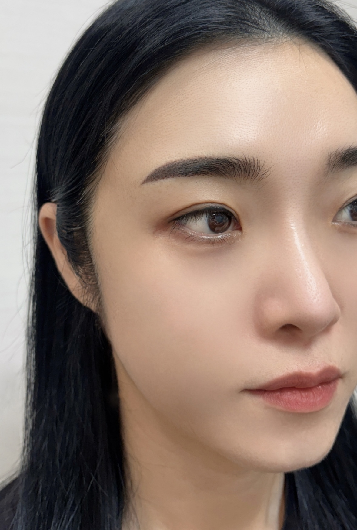 원본 이미지 · 얼굴 노출 있는 시술 후 컷